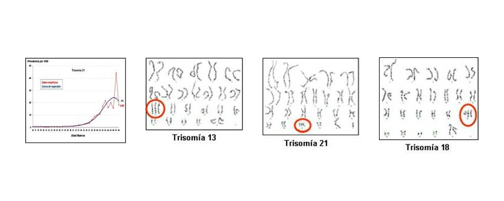 Trisomías (13, 21, 18)